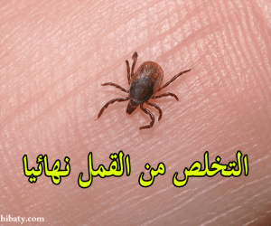 كيف اتخلص من القمل ؟ إليك افضل علاج القمل عند الاطفال و الكبار